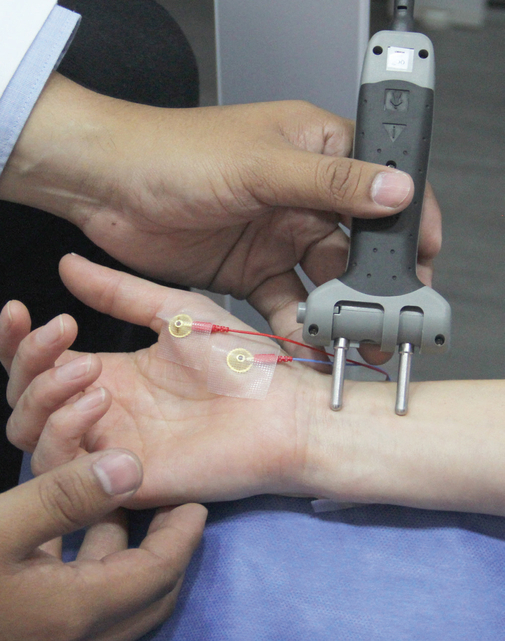 Electromyography (EMG) device